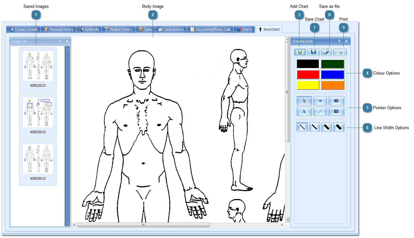 Body Chart